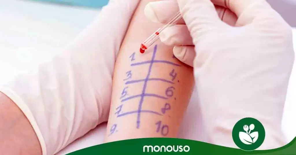 Dudas más comunes sobre alergias alimentarias